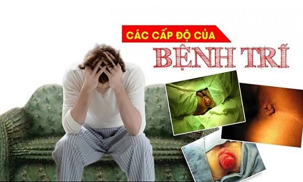 https://benhtribacninh.vn/wp-content/uploads/2025/08/cac-cap-do-cua-benh-tri.jpg