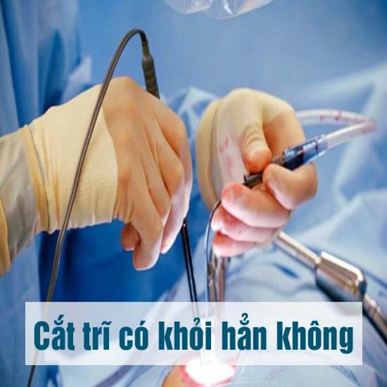 https://benhtribacninh.vn/wp-content/uploads/2025/08/cat-tri-co-khoi-han-khong-sau-cat-tri-co-tai-phat-khong.jpg
