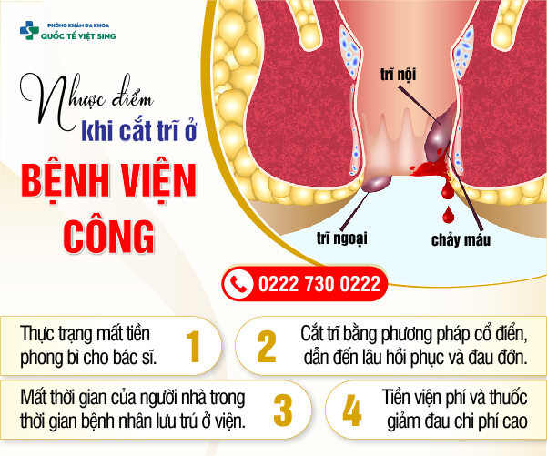 ITC – Giải pháp chữa trĩ an toàn tuyệt đối với cam kết 5 KHÔNG